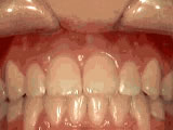 Close-up of healthy human teeth and gums