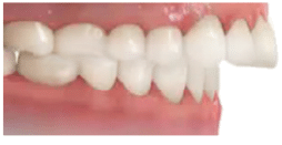 Close-up of healthy human teeth and gums