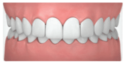 Detailed graphic of healthy human teeth and gums