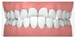 Close-up of perfect white teeth and healthy gums