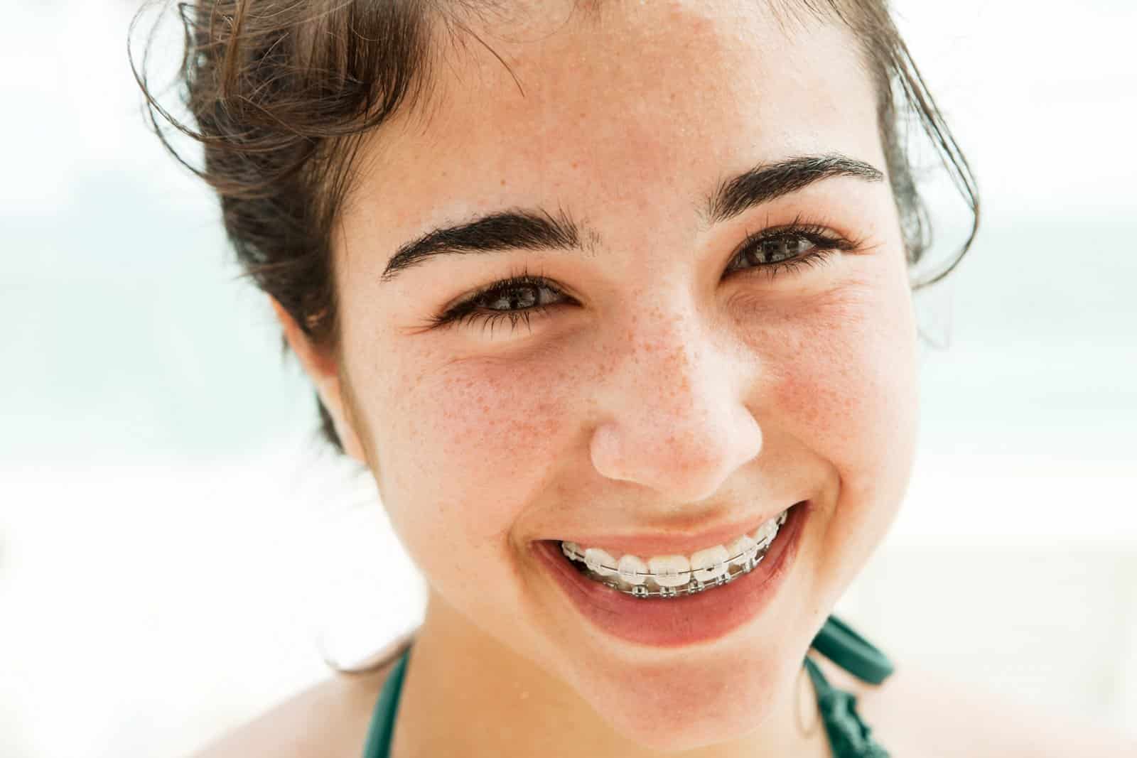 Young woman smiling with braces, freckles, close-up portrait